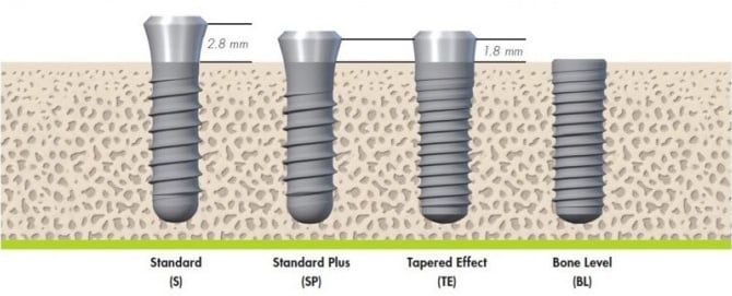 Straumann Dental Implants